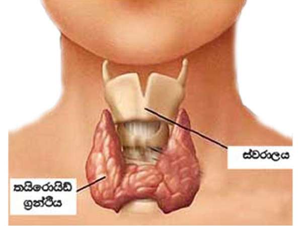 වායු ගෙඩි සුව කරන්න සැත්කම් ඕනැ නෑ