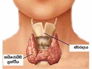 වායු ගෙඩි සුව කරන්න සැත්කම් ඕනැ නෑ