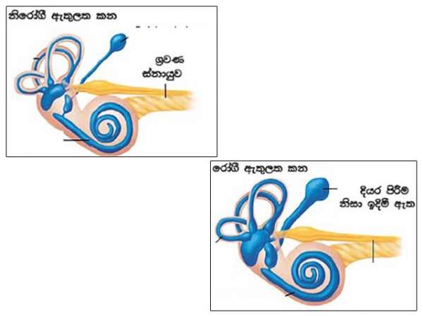 මොනවද මේ කර්ණරෝග