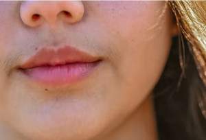 සිදුරේ අනවශ්‍ය ලෝම ඔබට හිසරදයක්ද ?